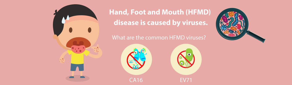 Hand, Foot and Mouth (HFMD) disease is caused by viruses.